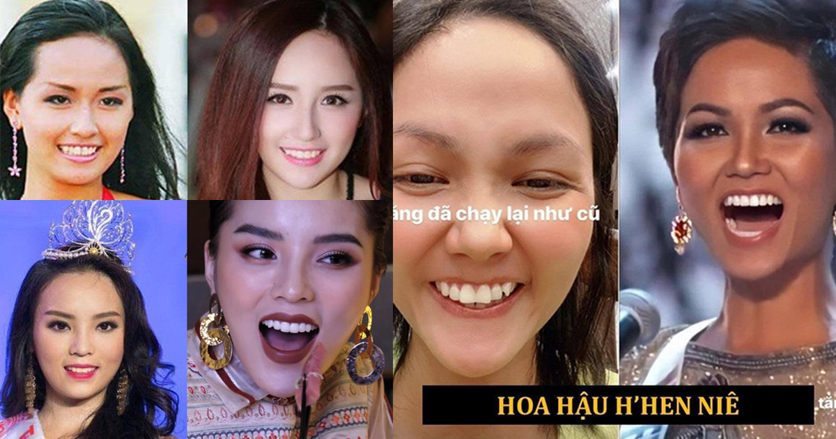 10 hoa hậu lột xác nhờ niềng răng: H'Hen Niê, Kỳ Duyên, Tiểu Vy đẹp rạng rỡ khiến fans nức lòng