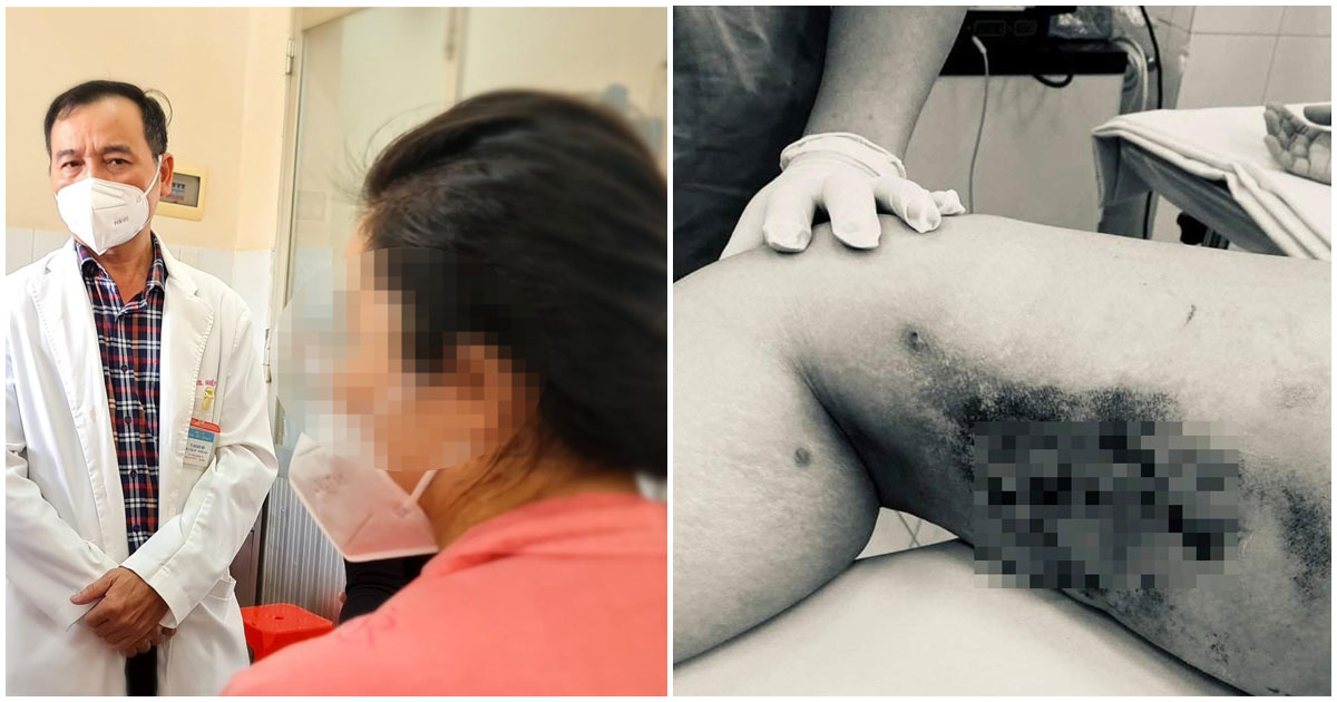 Thẩm mỹ viện tiêm "thần dược" tan mỡ, cô gái TPHCM bị hoại tử nặng vùng bụng, lưng