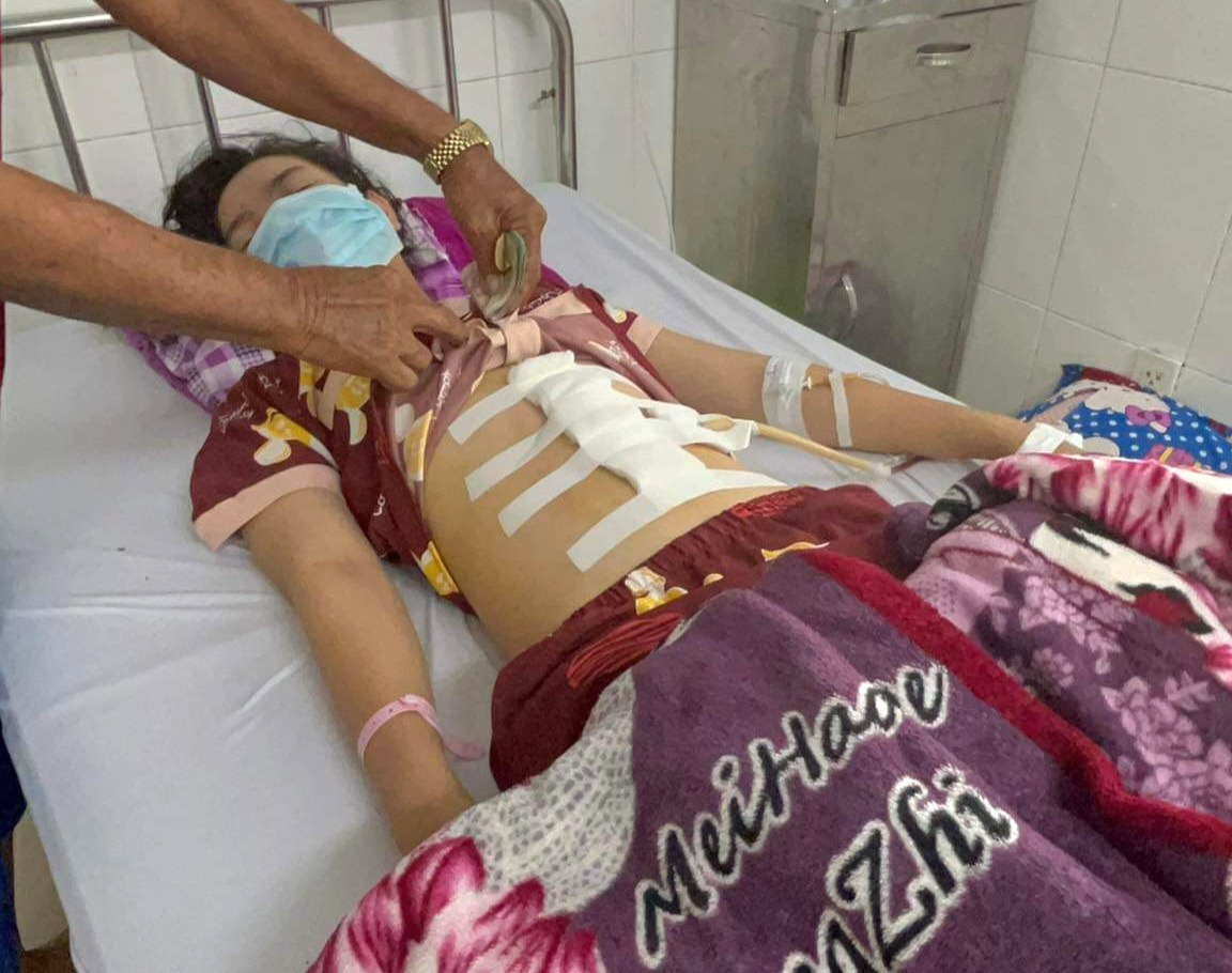 Bạc Liêu: Thiếu nữ 16 tuổi bị cha dượng đánh dập lá lách, gãy xương sườn