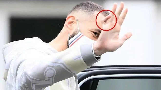 Bàn tay băng bó và nghị lực của Benzema