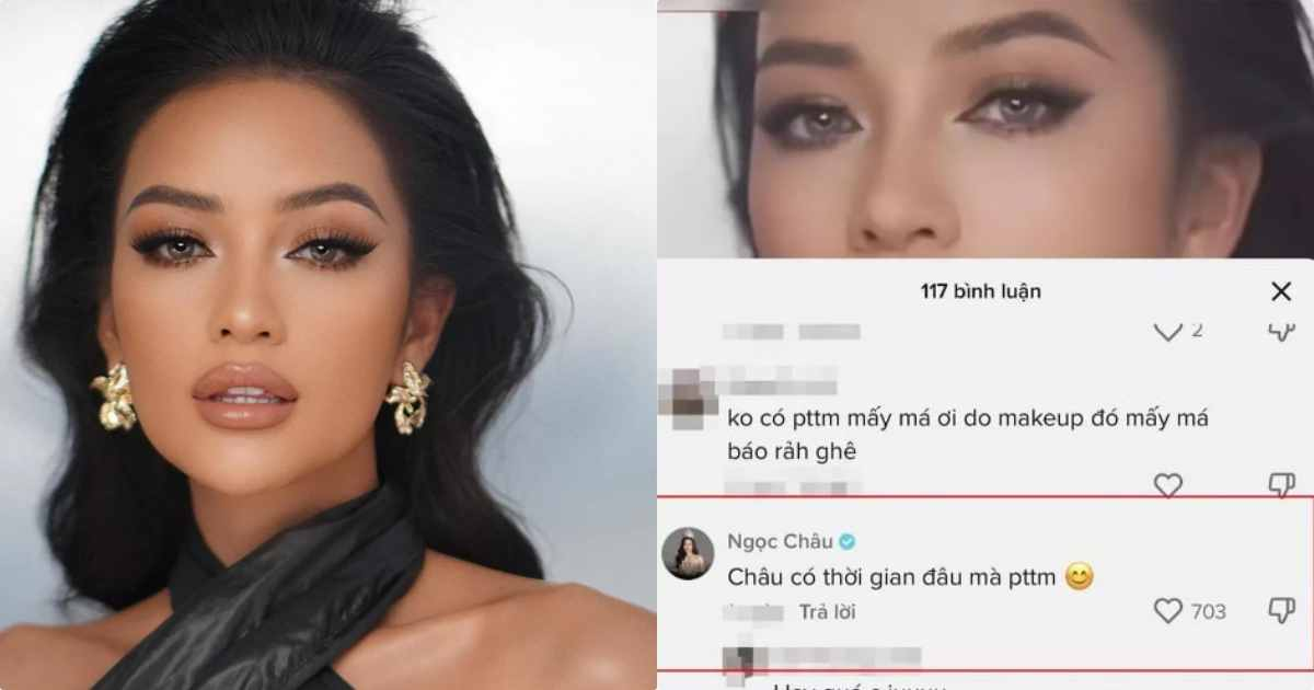 Hoa hậu Ngọc Châu có phản ứng "bất ngờ" trước những nghi vấn phẫu thuật thẩm mỹ