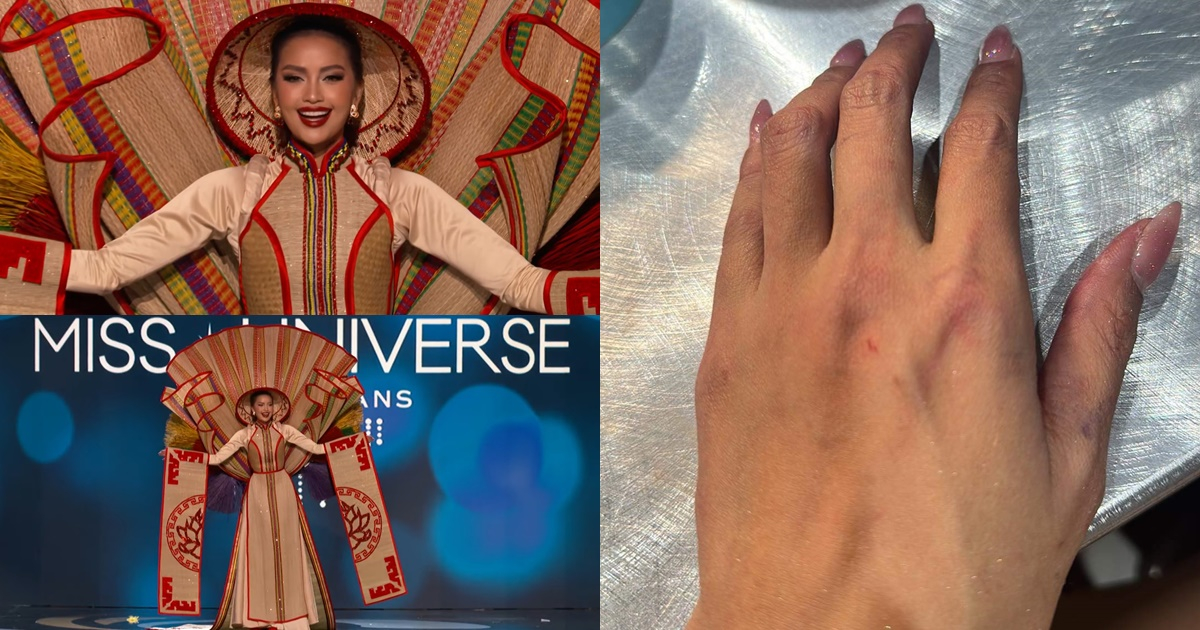 Ngọc Châu bị thương sau bán kết Miss Univesre 2022: "Em thấy mình giống như mới đi cày ruộng về"