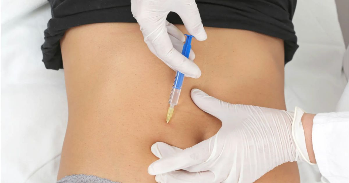 67 bệnh nhân bị ngộ độc sau khi tiêm botox dạ dày để giảm cân