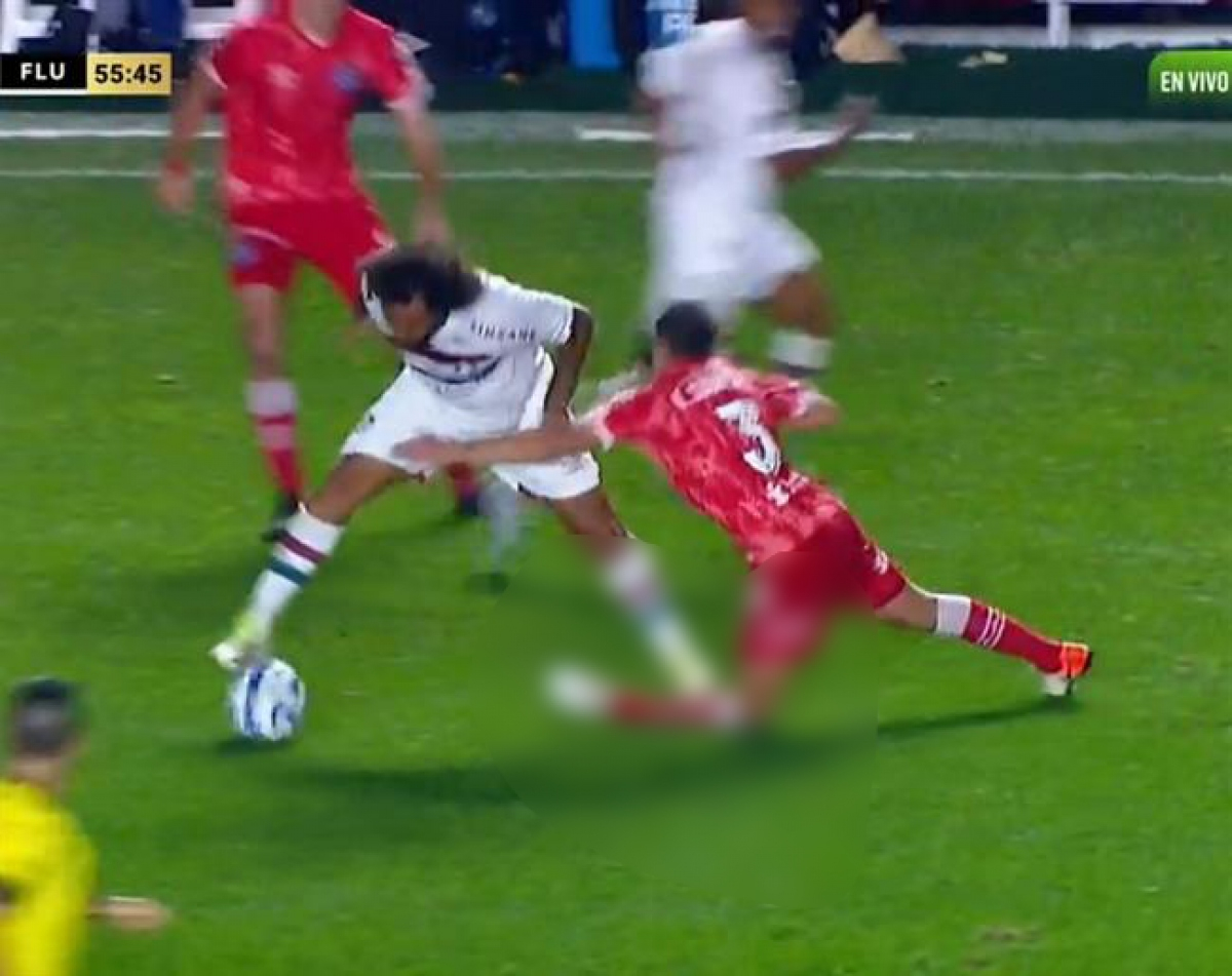 VIDEO: Ghê rợn cảnh Marcelo đạp gãy đôi chân đối thủ