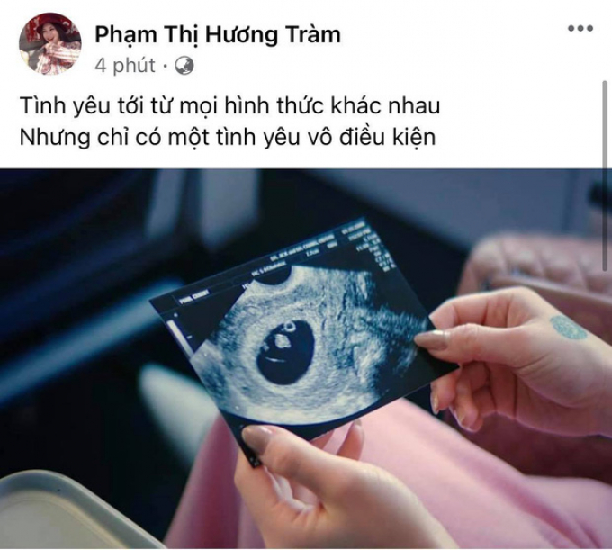 Hương Tràm trở lại đường đua Vpop, hé lộ cha của đứa trẻ trong tấm ảnh siêu âm gây bão