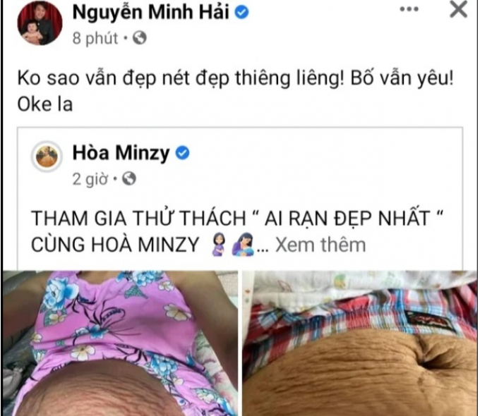 Hòa Minzy khoe vết rạn bụng sau khi sinh quý tử Bo, ông xã nói 1 câu ngọt ngào khiến fans nể phục