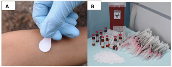 Miếng dán vắc xin hứa hẹn cách chủng ngừa Covid-19 không gây đau, hiệu quả cao