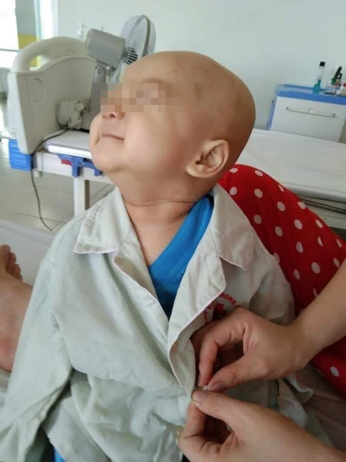 Nụ cười nhói lòng của bé 2 tuổi mắc 2 bệnh ung thư, ngây thơ nói con sắp chết