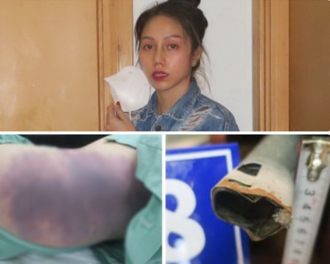 Hình ảnh kinh hoàng từ camera: Bé gái 8 tuổi suốt bị dì ghẻ đánh đập suốt 4 tiếng trước khi tử vong