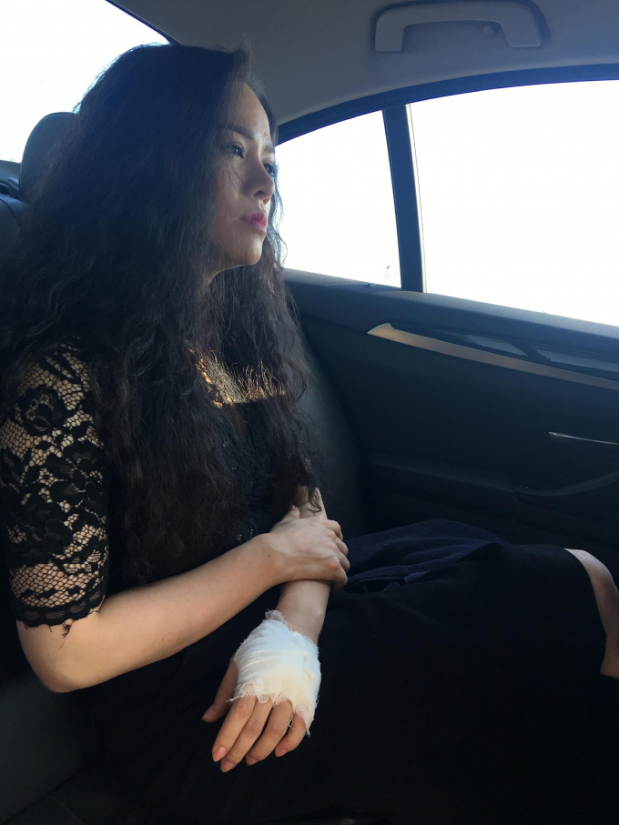 Nhật Kim Anh hé lộ hậu trường nghề diễn viên: Ăn ngủ xuề xòa, tay chân bầm dập khiến fans xót xa