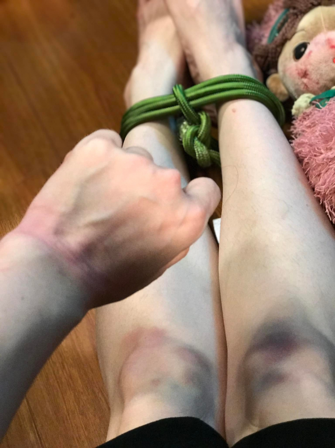 Nhật Kim Anh hé lộ hậu trường nghề diễn viên: Ăn ngủ xuề xòa, tay chân bầm dập khiến fans xót xa