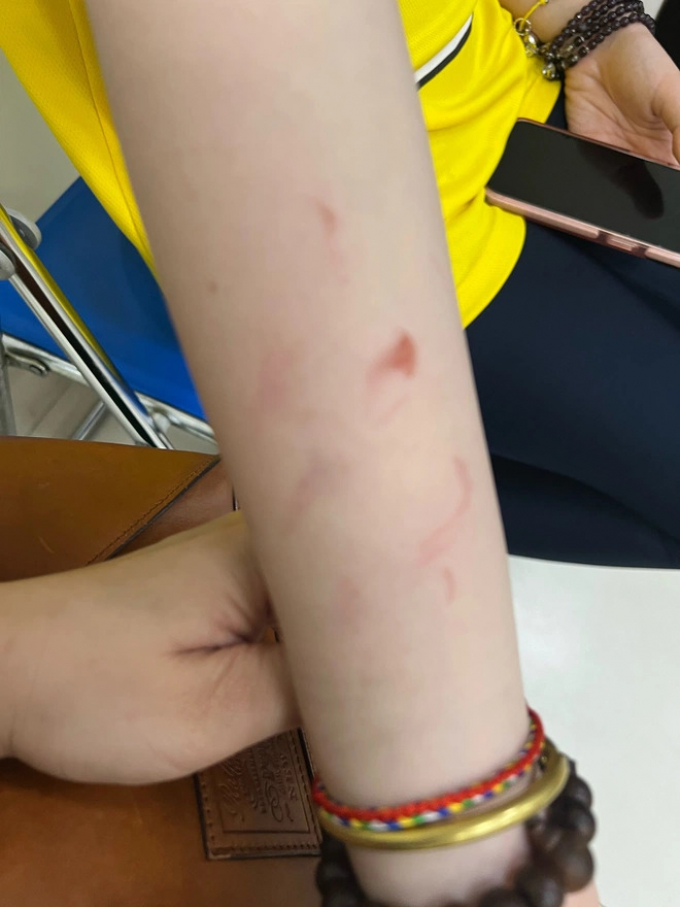 Trường quốc tế gặp biến vì vụ nữ sinh bị bạn học đánh: Fanpage ngập phẫn nộ, netizen đồng loạt cho 1 sao