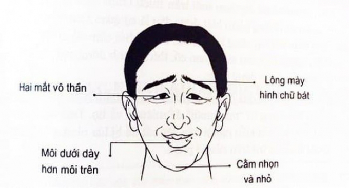 Đàn ông sở hữu 3 nét tướng này: Cuộc đời dễ gặp tai ương sóng gió