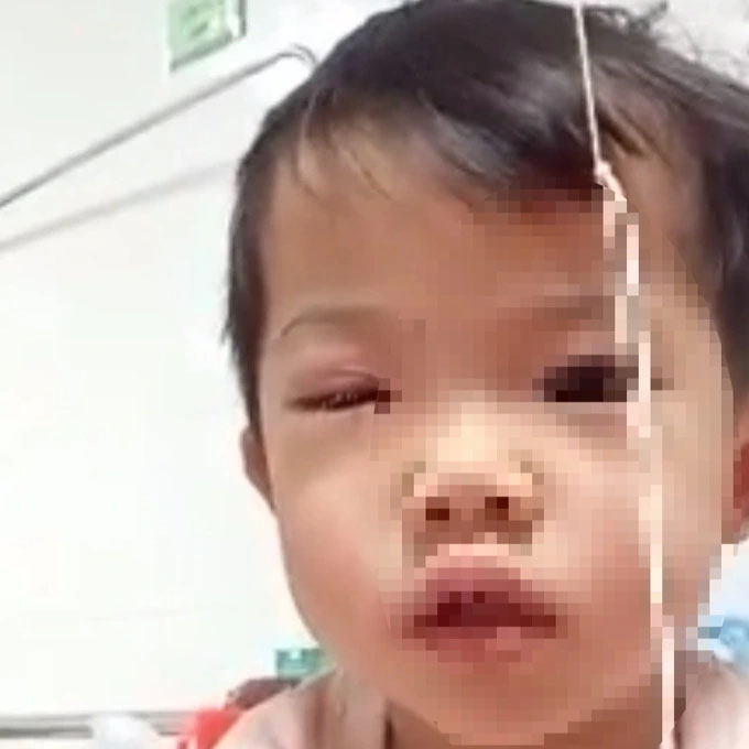 Bé gái 2 tuổi bị xịt hơi cay vào mắt trong vụ xô xát của người lớn