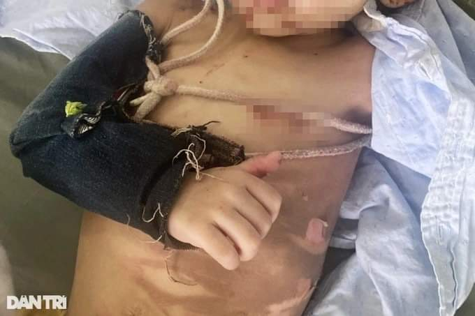 Cấp cứu bé 2 tuổi ở TPHCM người đầy vết thương, nghi bị cha bạo hành 3 ngày