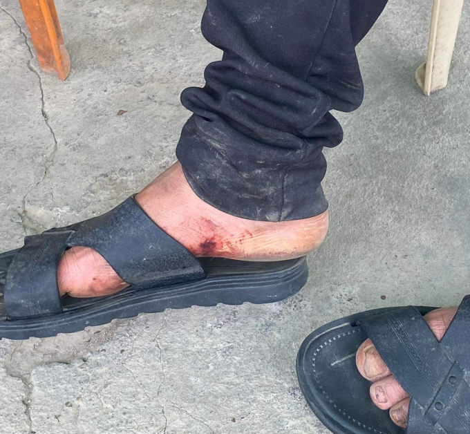 Hai người đi bộ gần 30km, chân rướm máu được công an, người dân Nghệ An hỗ trợ