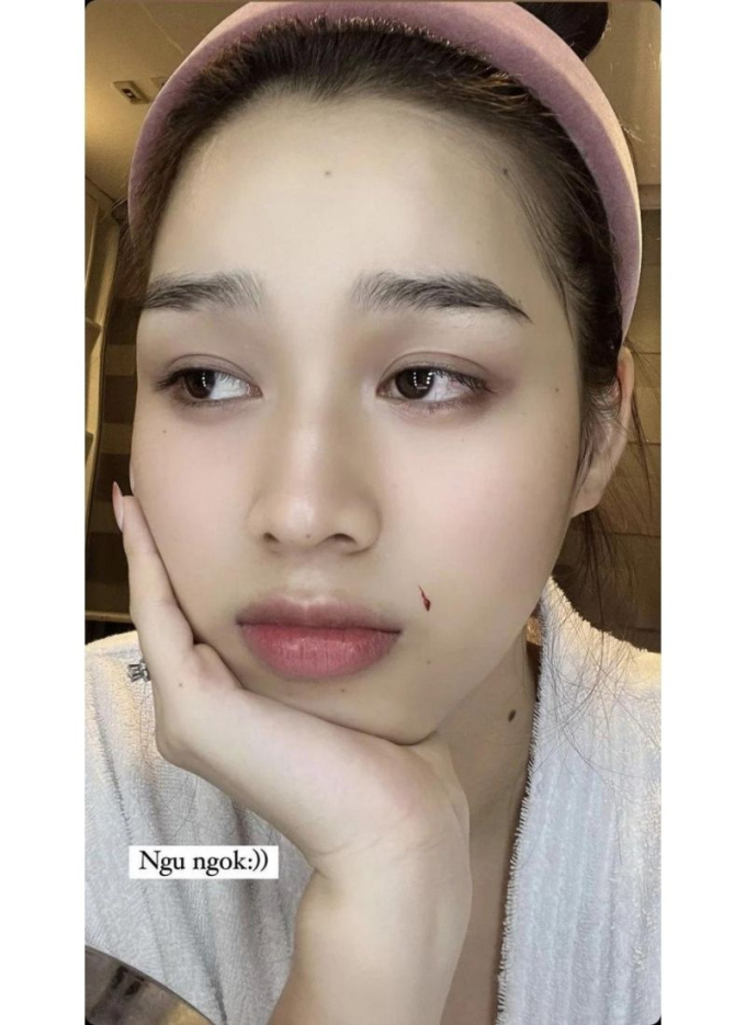 Hoa hậu Đỗ Hà gặp sự cố trong lúc chăm sóc da, nhan sắc xinh đẹp có bị ảnh hưởng?
