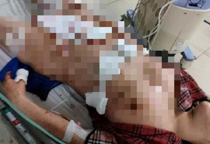 Hành hạ vợ dã man và loạt vụ bạo hành vì ghen gây chấn động