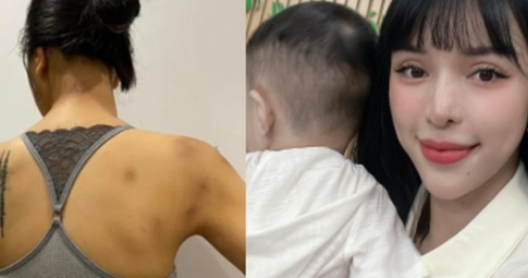 Nữ siêu mẫu Việt từng bị bạn trai bạo hành lúc mang thai giờ sống thế nào?